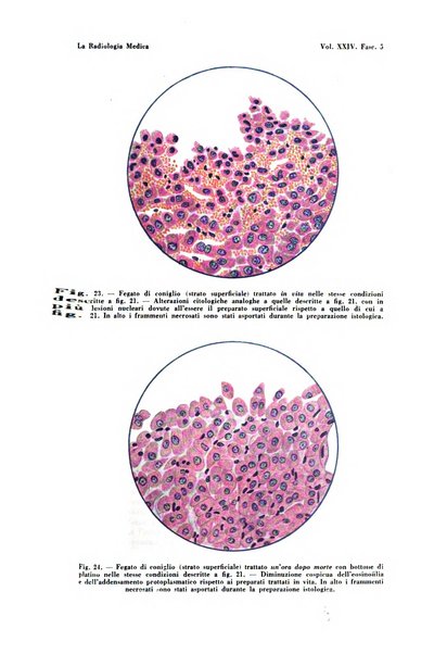 La radiologia medica rivista mensile