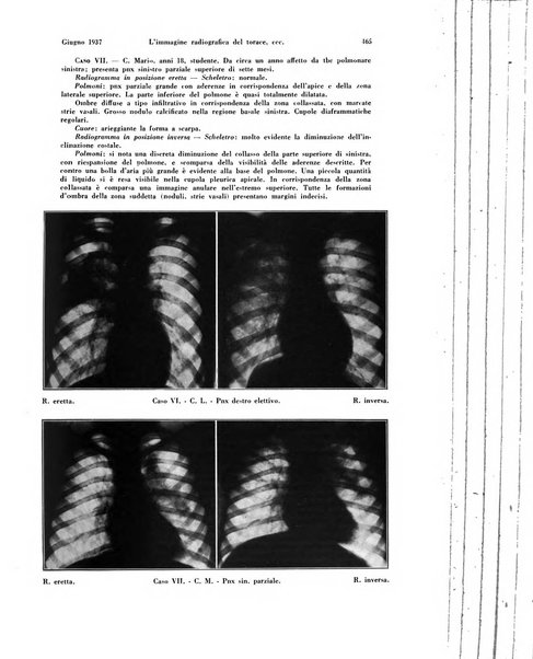 La radiologia medica rivista mensile