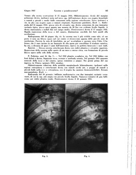 La radiologia medica rivista mensile