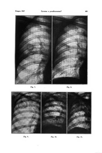 La radiologia medica rivista mensile