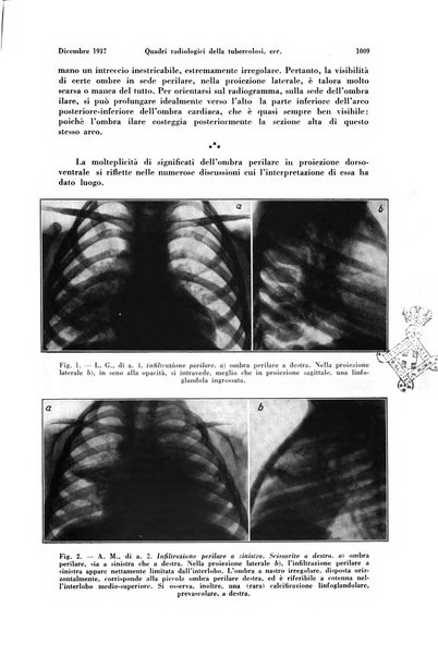 La radiologia medica rivista mensile