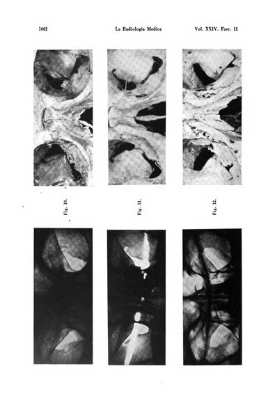 La radiologia medica rivista mensile