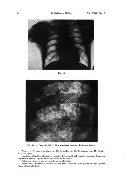 La radiologia medica rivista mensile