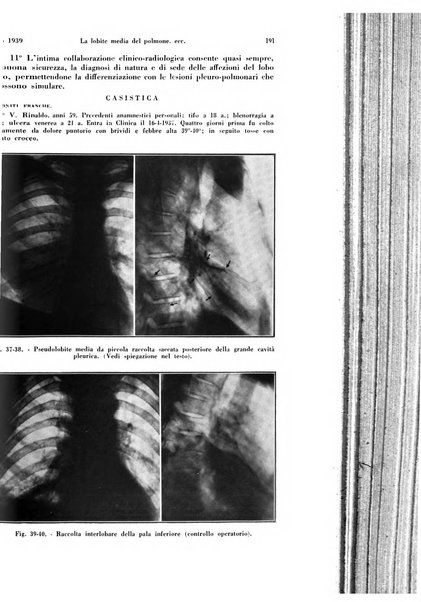 La radiologia medica rivista mensile