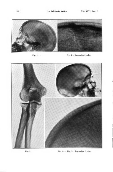 La radiologia medica rivista mensile