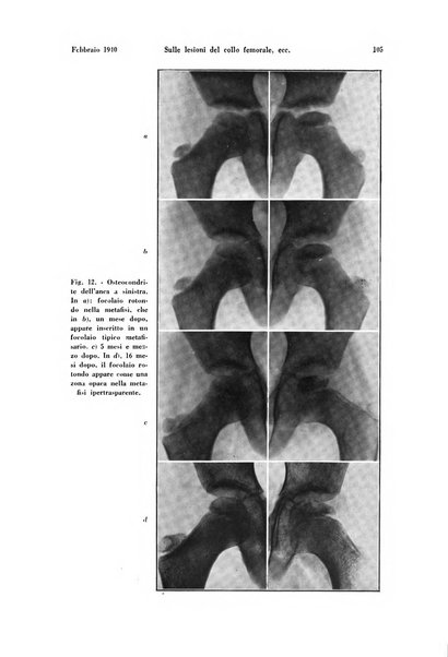 La radiologia medica rivista mensile