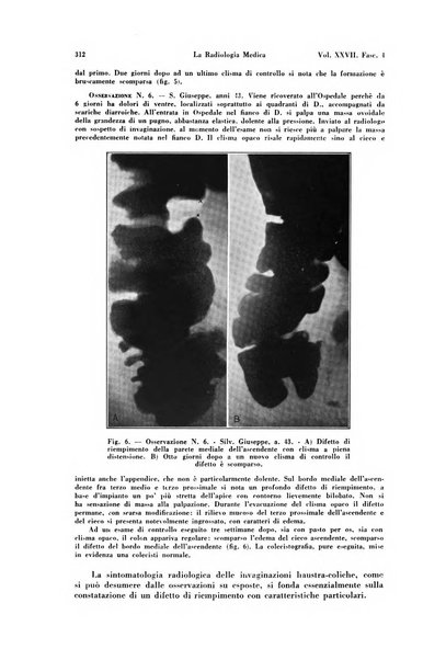 La radiologia medica rivista mensile