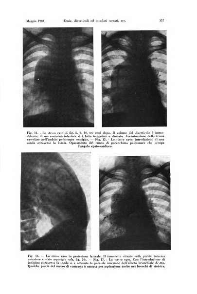 La radiologia medica rivista mensile