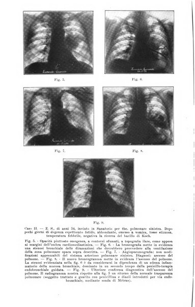 La radiologia medica rivista mensile