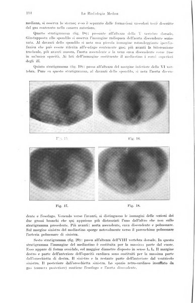 La radiologia medica rivista mensile