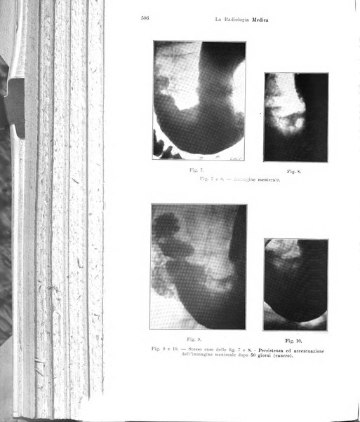 La radiologia medica rivista mensile