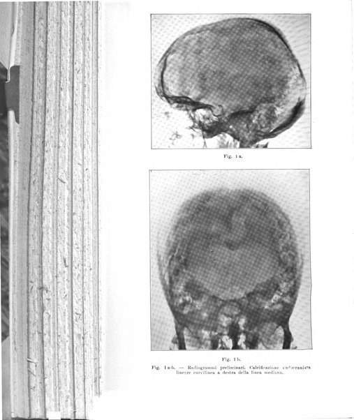 La radiologia medica rivista mensile