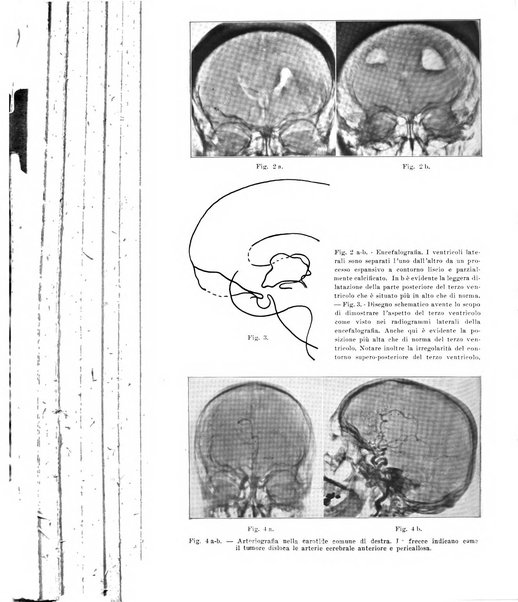 La radiologia medica rivista mensile