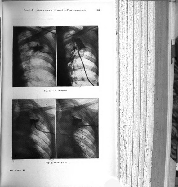 La radiologia medica rivista mensile