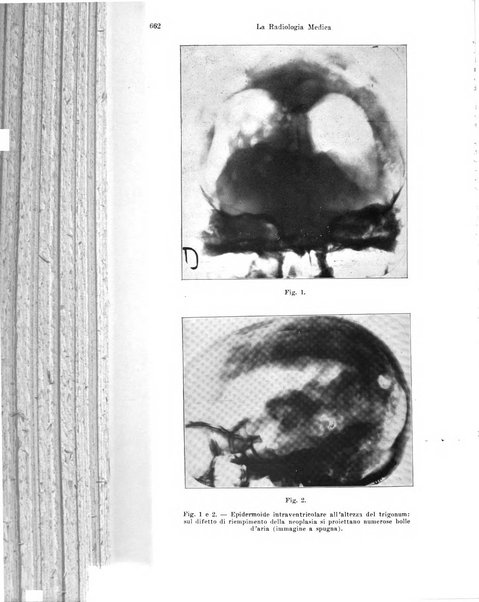 La radiologia medica rivista mensile