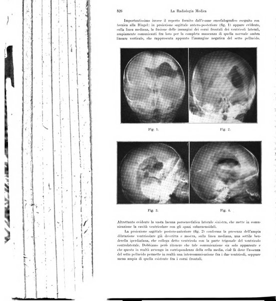 La radiologia medica rivista mensile