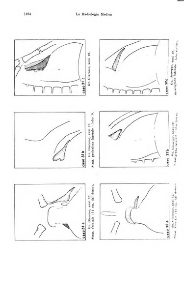 La radiologia medica rivista mensile