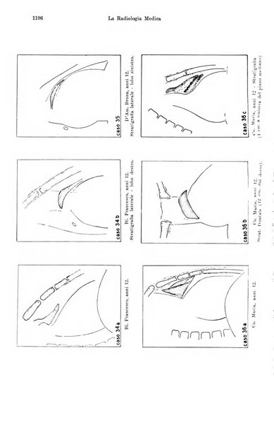 La radiologia medica rivista mensile