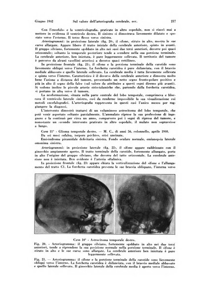 La radiologia medica rivista mensile