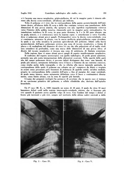 La radiologia medica rivista mensile