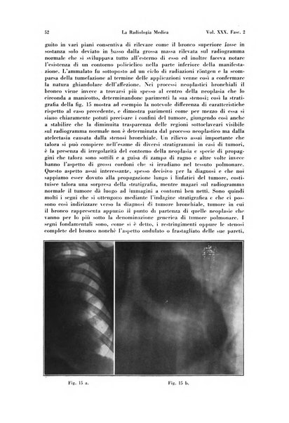 La radiologia medica rivista mensile