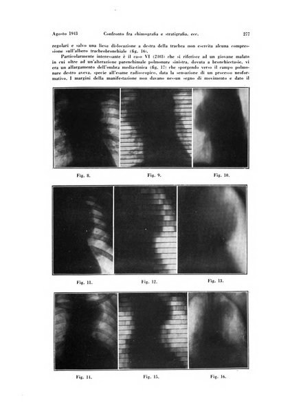 La radiologia medica rivista mensile