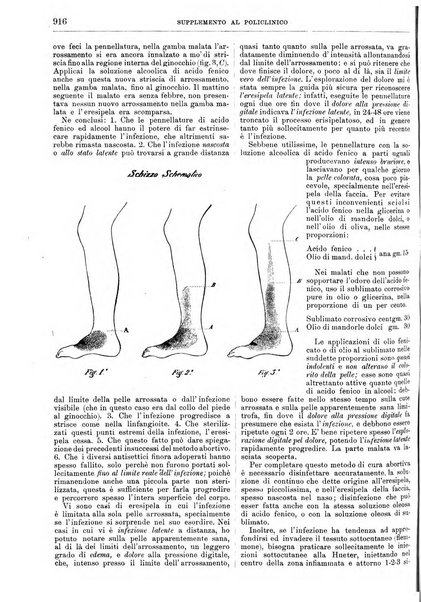 Supplemento al policlinico periodico di medicina, chirurgia ed igiene