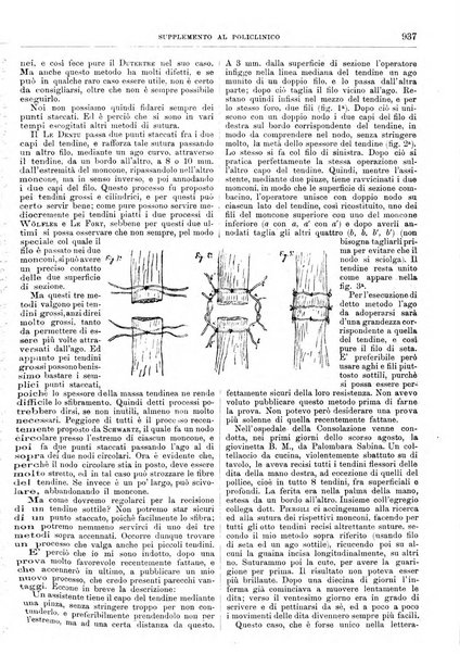 Supplemento al policlinico periodico di medicina, chirurgia ed igiene