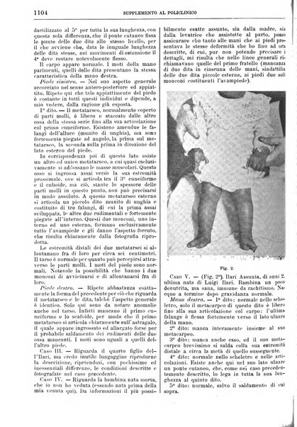 Supplemento al policlinico periodico di medicina, chirurgia ed igiene