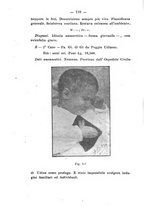 giornale/NAP0004978/1919/unico/00000140