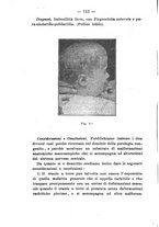 giornale/NAP0004978/1919/unico/00000142