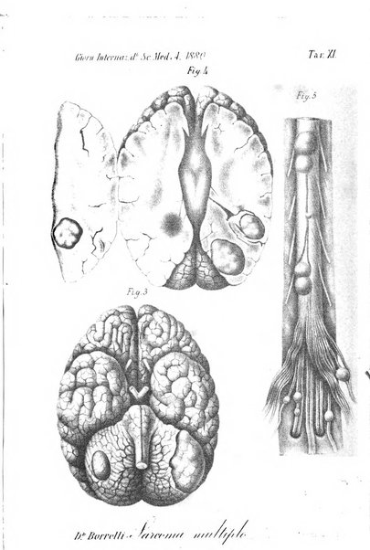 Giornale internazionale delle scienze mediche