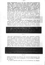 giornale/NAP0021576/1911/unico/00000404