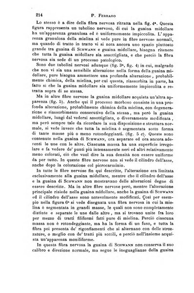 Il morgagni giornale indirizzato al progresso della medicina. Parte 1., Archivio o Memorie originali