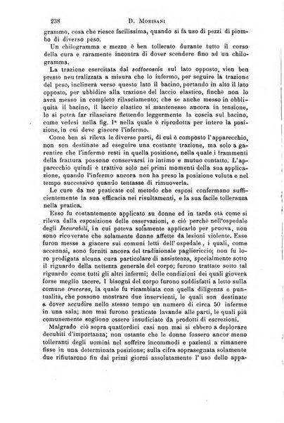 Il morgagni giornale indirizzato al progresso della medicina. Parte 1., Archivio o Memorie originali