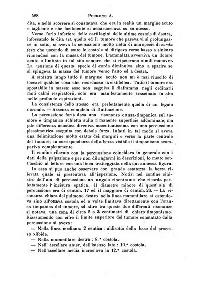 Il morgagni giornale indirizzato al progresso della medicina. Parte 1., Archivio o Memorie originali