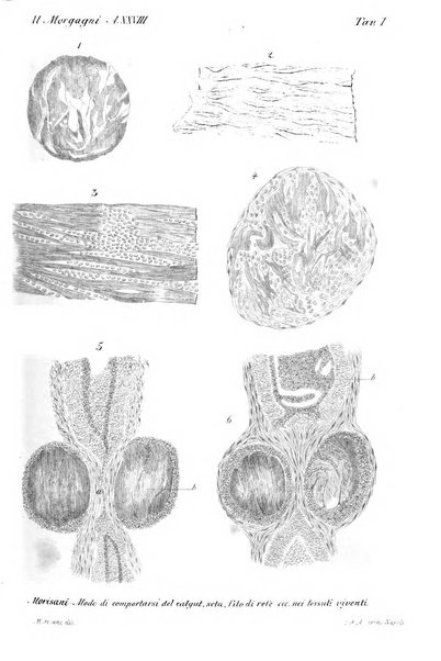 Il morgagni giornale indirizzato al progresso della medicina. Parte 1., Archivio o Memorie originali