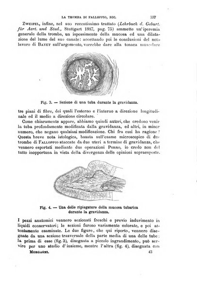 Il morgagni giornale indirizzato al progresso della medicina. Parte 1., Archivio o Memorie originali