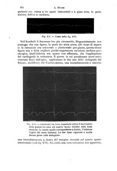 Il morgagni giornale indirizzato al progresso della medicina. Parte 1., Archivio o Memorie originali