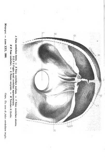 Il morgagni giornale indirizzato al progresso della medicina. Parte 1., Archivio o Memorie originali