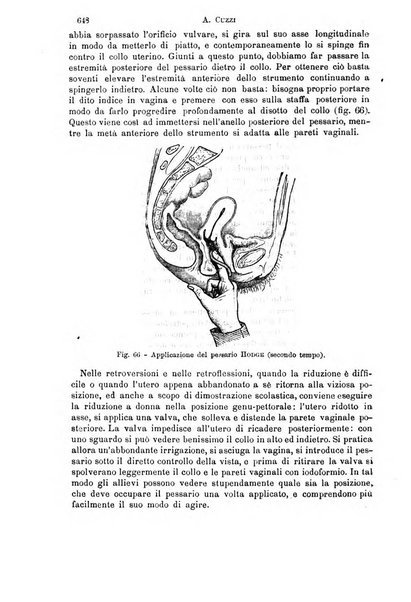 Il morgagni giornale indirizzato al progresso della medicina. Parte 1., Archivio o Memorie originali