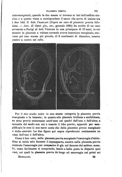 Il morgagni giornale indirizzato al progresso della medicina. Parte 1., Archivio o Memorie originali