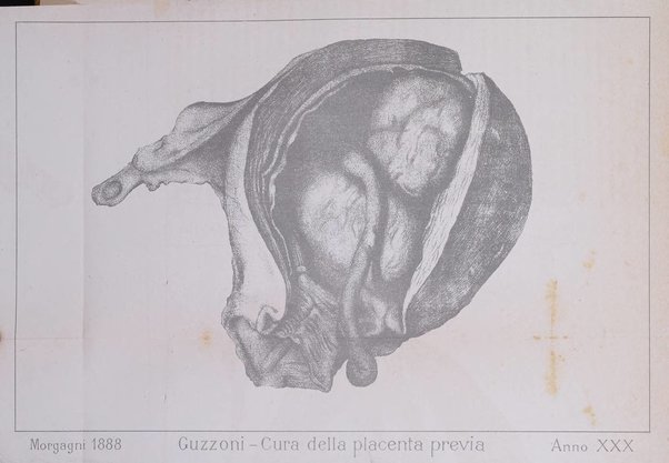 Il morgagni giornale indirizzato al progresso della medicina. Parte 1., Archivio o Memorie originali