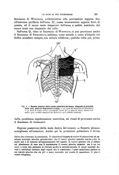 Il morgagni giornale indirizzato al progresso della medicina. Parte 1., Archivio o Memorie originali