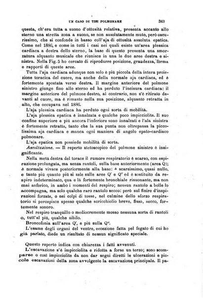 Il morgagni giornale indirizzato al progresso della medicina. Parte 1., Archivio o Memorie originali