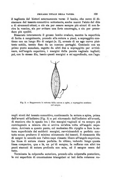 Il morgagni giornale indirizzato al progresso della medicina. Parte 1., Archivio o Memorie originali