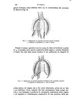 giornale/NAP0034716/1889/unico/00000690