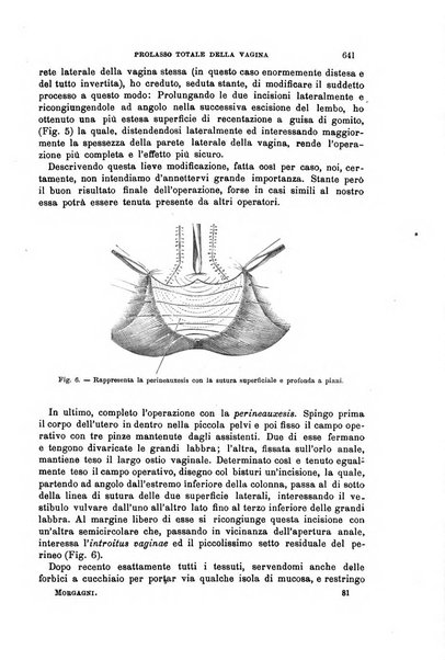 Il morgagni giornale indirizzato al progresso della medicina. Parte 1., Archivio o Memorie originali