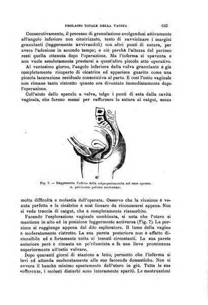 Il morgagni giornale indirizzato al progresso della medicina. Parte 1., Archivio o Memorie originali