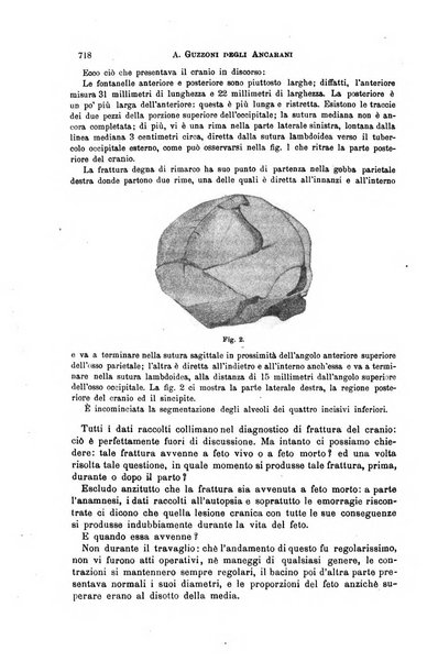 Il morgagni giornale indirizzato al progresso della medicina. Parte 1., Archivio o Memorie originali